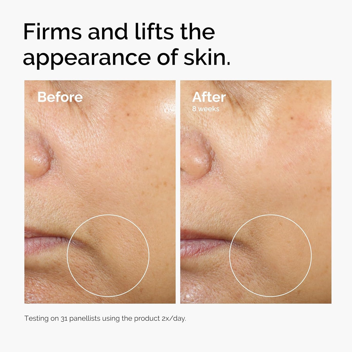 The Ordinary Caffeine 3% + Escin 1% Face Serum, Energizing Serum to Tone and Tighten, 1 Fl Oz