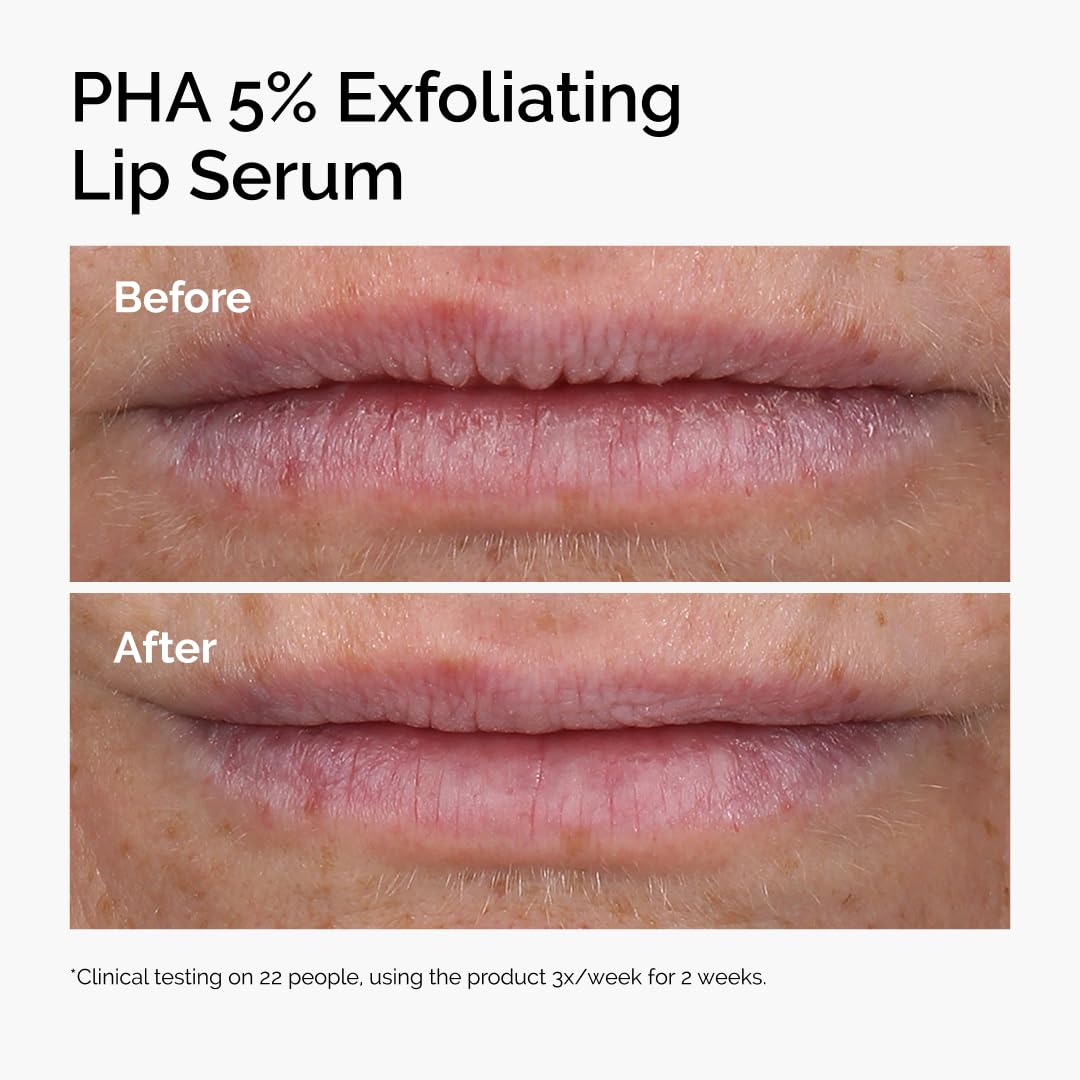 The Ordinary PHA 5% Exfoliating Lip Serum, Hydrating Overnight Lip Exfoliator Treatment, 0.5 Fl Oz