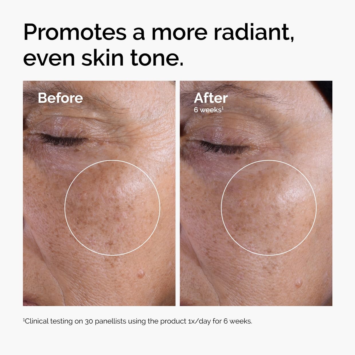 The Ordinary The Mini Icons Set, Travel Size Skin Care to Hydrate and Brighten, Glycolic Acid 7% Exfoliating Toner, Niacinamide 10% + Zinc 1%, Hyaluronic Acid 2% + B5, 4 Reusable Rounds