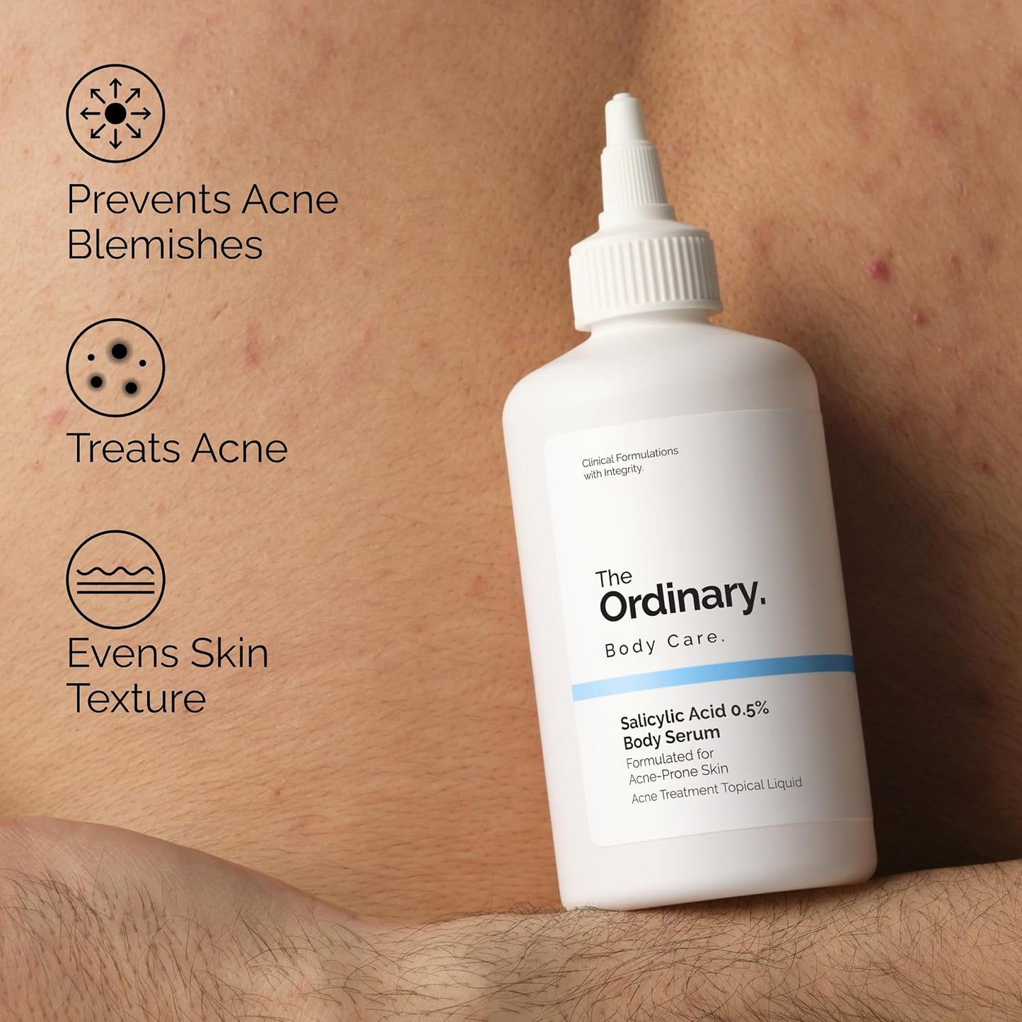 The Ordinary Salicylic Acid 0.5% Body Serum, Exfoliating Treatment for Acne-Prone Skin, 8.1 Fl Oz