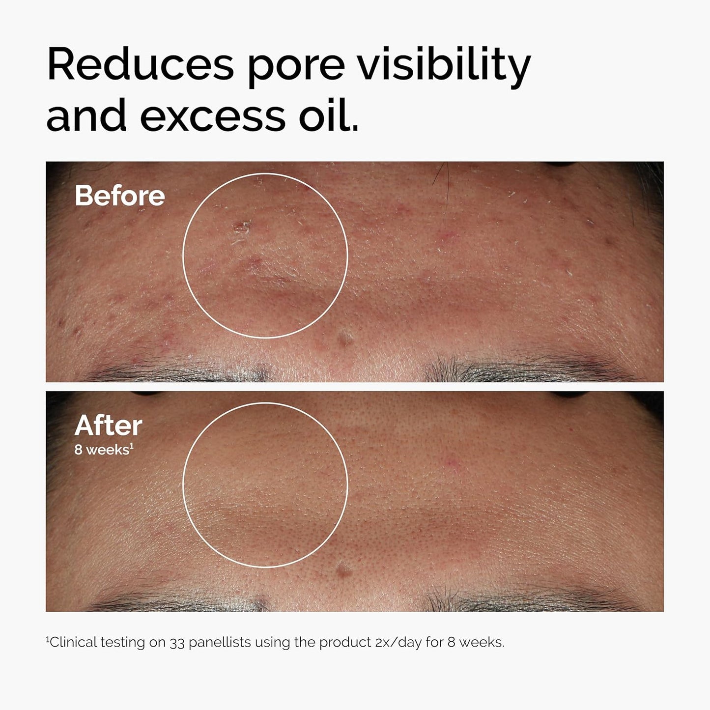 The Ordinary Serum Favorites Set – Hyaluronic Acid 2% + B5, Niacinamide 10% + Zinc 1%, Caffeine Solution 5% + EGCG Eye Serum, Serums for Hydrating, Brightening & Pore-Minimizing Skin Care