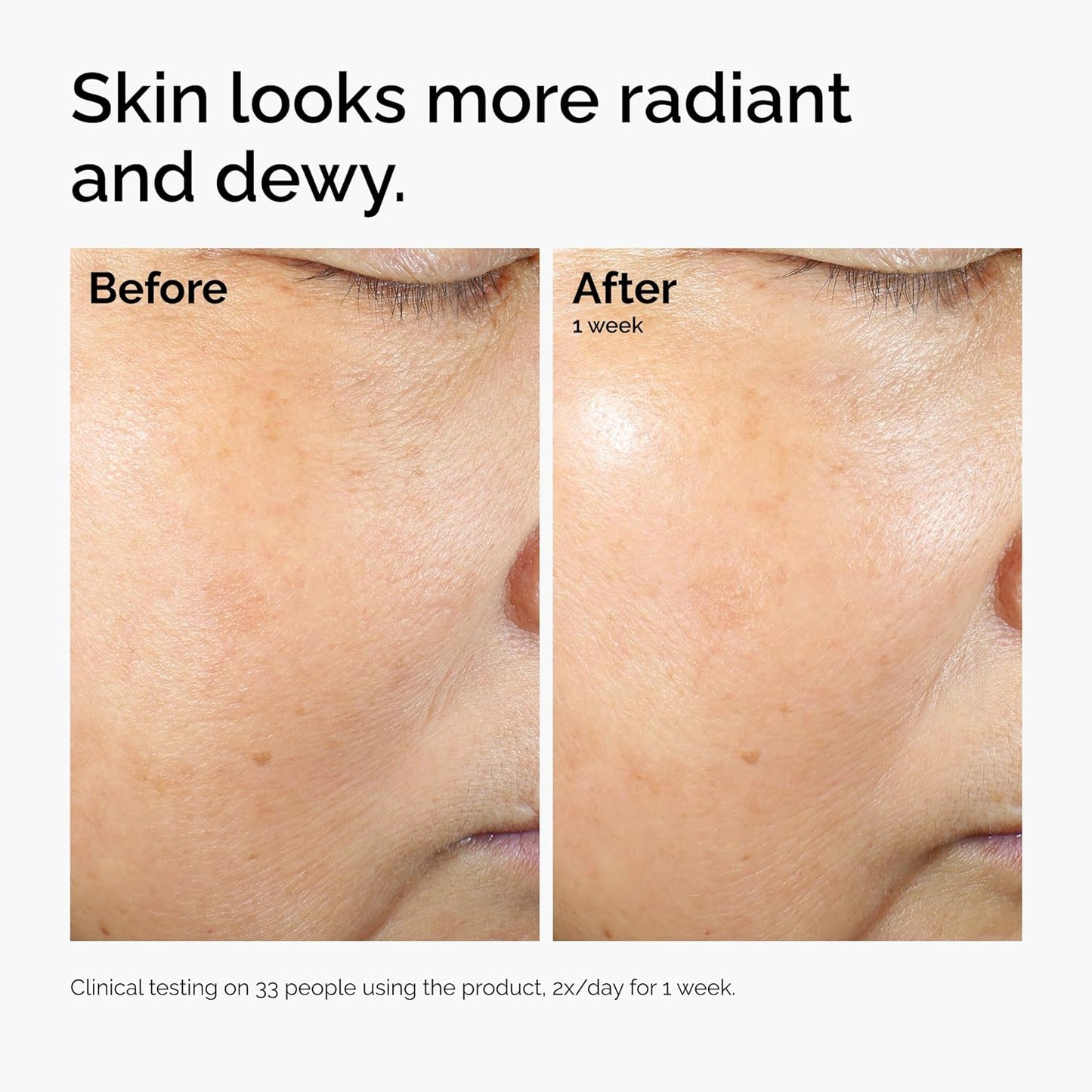 The Ordinary Rice Lipids + Ectoin Microemulsion Moisturizer for Dry Skin, Soothing Hydration, Barrier Repair, Reduced Redness