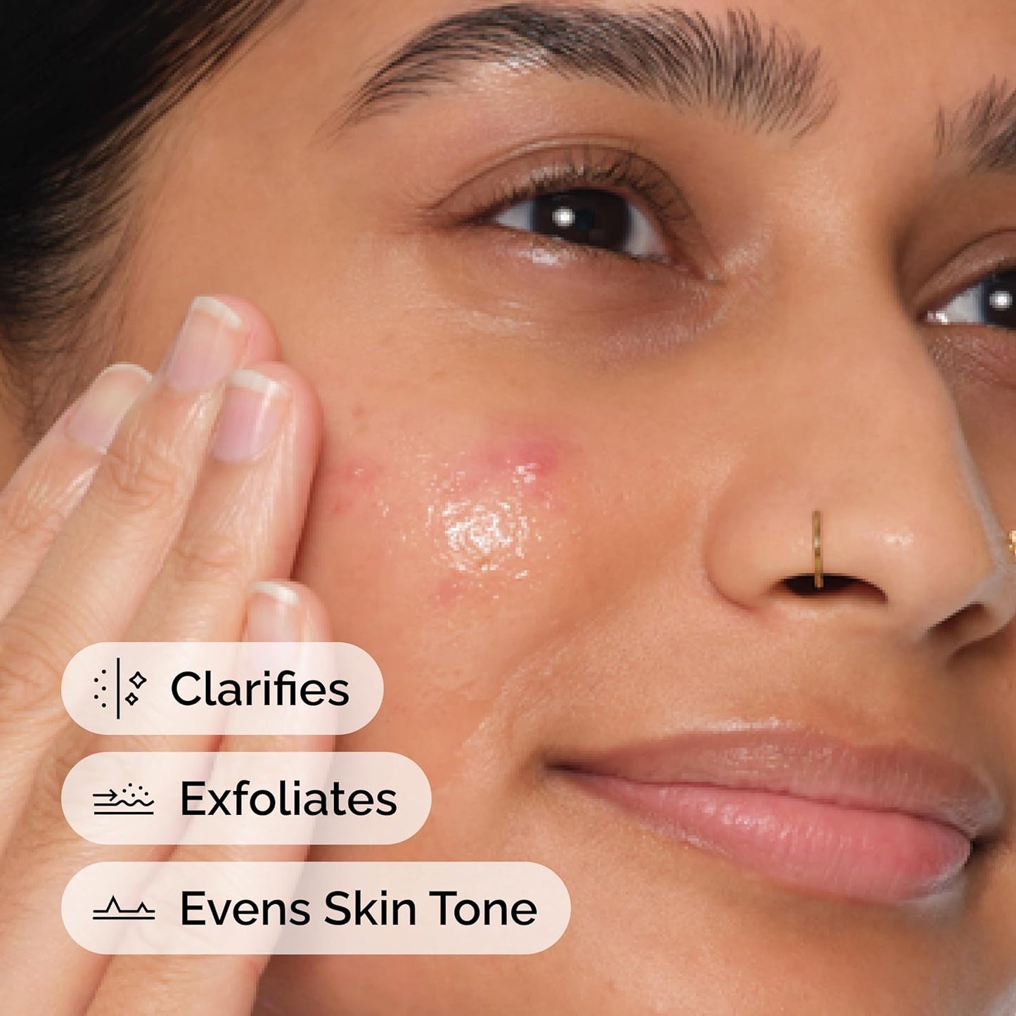 The Ordinary Salicylic Acid 2% Anhydrous Solution, Gentle Exfoliating Serum for Blemish-Prone Skin and Uneven Texture